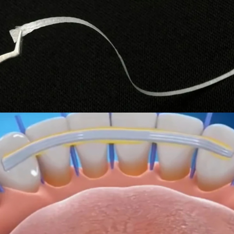1/2/3/5Pc Splint Kaca untuk Fi - Teeth Whitening Strips Lumineux ulasan dan harga