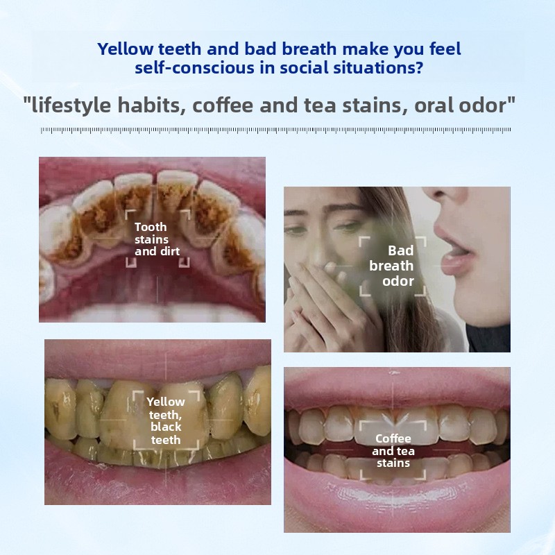 Bubuk Gigi Pemutih dan Pencera - Teeth Whitening Enzymes ulasan dan harga