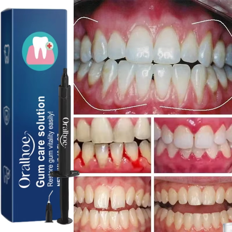 Gel Pemutih Gigi Perawatan Per - Teeth Whitening Gel ulasan dan harga