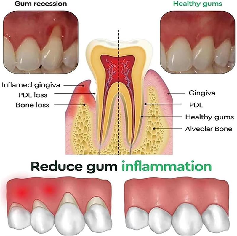 Gel Pemutih Gigi Perawatan Per - Teeth Whitening Gel ulasan dan harga