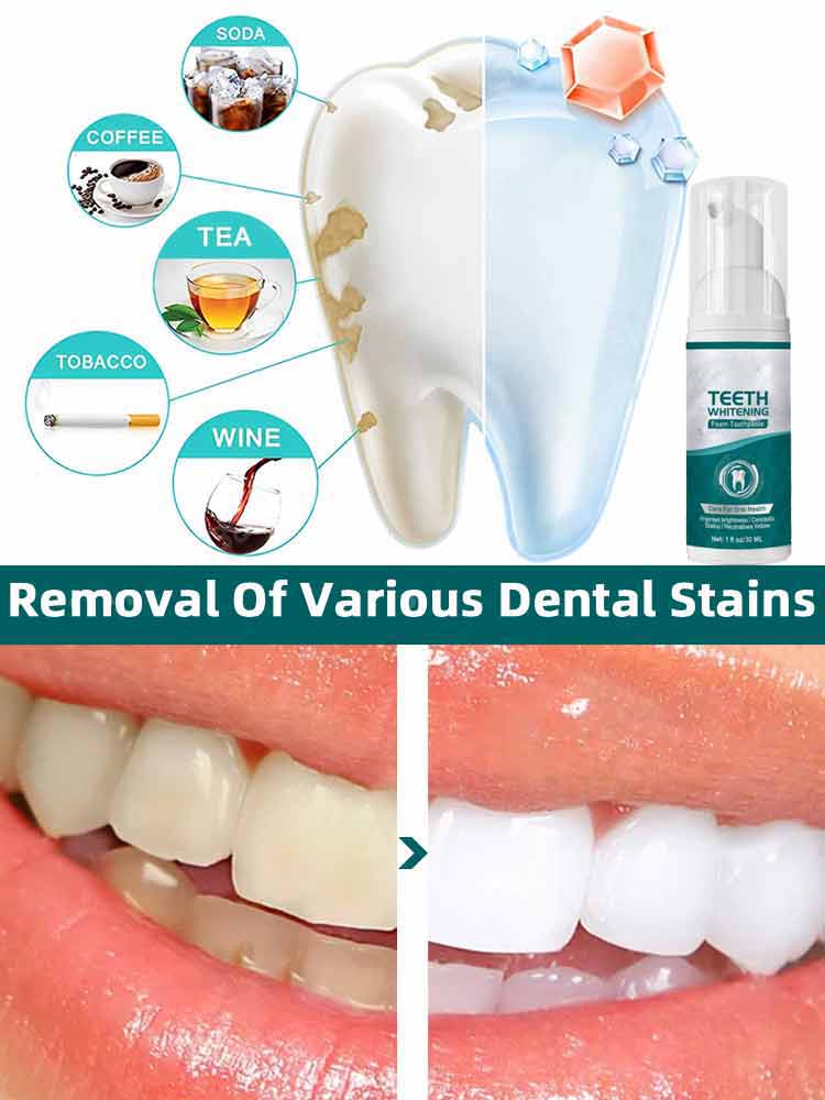 Perawatan Kerusakan Gigi 3RD M - Remineralizing Toothpaste ulasan dan harga