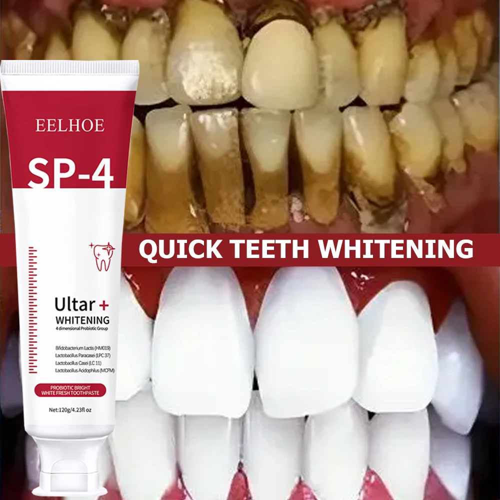 5 buah Sp-4 120g pasta gigi pe - Teeth Whitening Enzymes ulasan dan harga